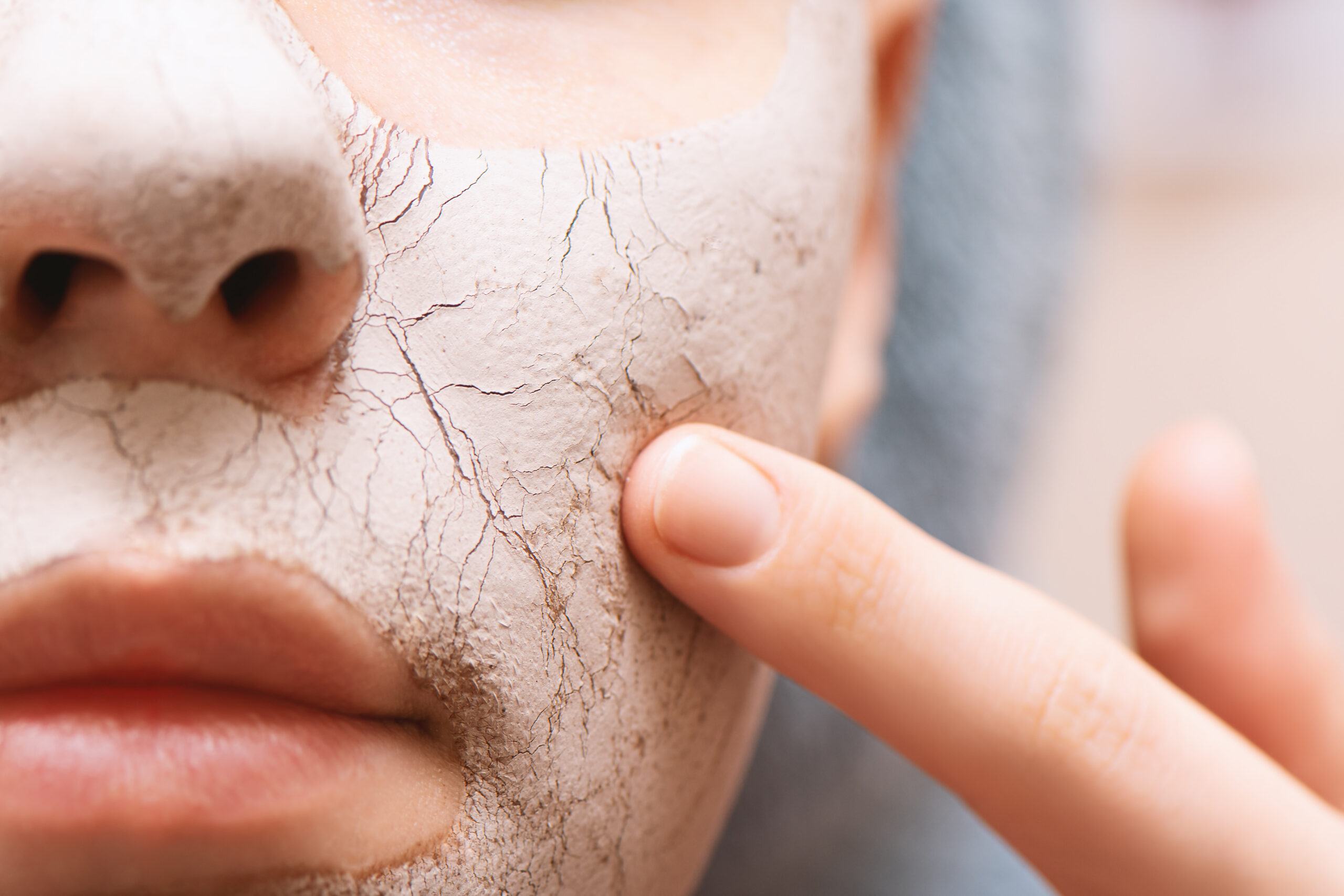 Mujer aplicándose un tratamiento en el rostro para tratar la piel seca.